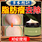 洛芝堂消除脂肪瘤硬包块去除药膏脂肪包块消除膏脂肪康去除膏脂肪瘤专用 消瘤膏【单盒装】