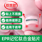 Dr.JYS甲沟炎矫正器钛合金硅胶款指甲长肉里嵌甲专用正甲贴片