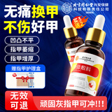 内廷上用北京同仁堂灰指甲护理液锉刀+棉签+创口贴发黄增厚非山藥特傚液