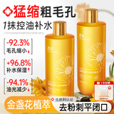 透真金盏花爽肤水控油祛痘湿敷水保湿收缩毛孔补水提亮去黄去闭口粉刺