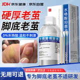 ADPWY水杨酸抑菌液脚底老茧去除可搭老茧软化膏茧子去除硬皮100ml
