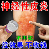 千草本原神经性皮炎专用的药膏顽固皮肤瘙痒皮炎皮癣湿疹真菌感染止痒喷剂 特效 3盒喷剂+3盒膏【200%消除】