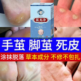 DAGO清茧灵茧立净去老茧子手脚厚去脚底老茧去硬皮官方软化剂脚部手茧