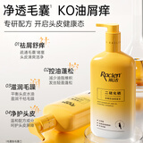 雨洁（RACLEN）洗发水去屑止痒控油蓬松洗发露男女通用洗发膏官方正品 去屑控油洗发水1瓶500g