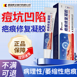 代文脸上坑坑洼洼痘坑痘印痘疤男士凹洞凹陷疤痕可搭祛痘修复凝胶CN 【3盒】买二送一，少量较深 痘坑