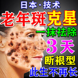 藤川岗田祛斑点斑专用水药去斑霜去黑色素脸部手背医用正品老年斑晒斑进口 买2发3【500%包裉除】日本进口一夜消 美白淡化祛斑霜黄褐雀斑晒斑男女士用的中药特效