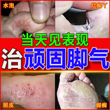 脚气药止痒脱皮烂脚丫真菌感染根药治脚气烂脚丫的特新效药脚烂脚趾缝痒溃烂水泡型严重脚气专用药克霉唑乳膏 3乳膏+3喷雾【搭配使用 效果佳【发货特效】止痒药