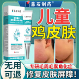 藤石制药儿童鸡皮肤毛周角化去除神器药脸部软化毛囊角化症脸上有小颗粒O6 正品保障  修复皮肤屏障专用  无用可退