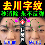 川字纹去除神器填充抬头纹去除男女重度去皱纹去法令纹贴睡觉贴膏 【1盒赋颜抗皱嫩肤霜】