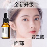 阿琪思面部丰盈精华液太阳穴眼窝泪沟额头脸颊苹果肌脸部妆后效果凹陷 两瓶