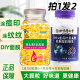 贝斯迪维生素E软胶囊100粒500mg大颗粒可加玫瑰油涂抹斑点痘印 1瓶VE+1瓶蓝莓叶黄素软糖