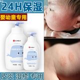 儿童身体乳保湿止痒干性湿疹宝宝身体乳特应性皮炎秋冬干燥瘙痒润肤乳皮炎性皮肤瘙痒滋润防干裂婴儿面霜 单盒【保湿止痒儿童身体乳】