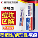 代文脸上坑坑洼洼痘坑痘印痘疤男士凹洞凹陷疤痕可搭祛痘修复凝胶CN 火热推荐【5盒】大量或较深 痘坑