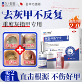 久卜制药日本灰指甲喷剂专用指甲真菌感染脱甲坏甲发黄增厚变白 1盒
