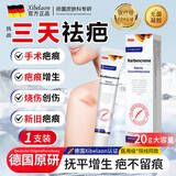 XIBELAON德国医用祛疤膏疤痕贴专用修复灵疤克去疤烧烫伤增生疤痕儿童凝胶 伤痕膏疤痕生长因子搭硅酮凝胶1支20g