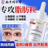 南京同仁堂脂肪粒去除神器汗管粒油脂粒颗粒清肌精华液眼霜补水保湿男女30ml 3瓶共90ml