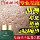 同仁堂祛痘膏去痘印修复淡化痘印痘坑20g