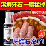Moihanr德国去牙结石专用清理神器去口臭去牙渍烟渍溶解液搭牙膏漱口水