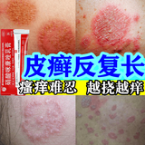 [扬子洲]硝酸咪康唑乳膏 2%*20g 1盒装 体股癣牛皮肤癣专用特正效药银屑病药膏止痒抑菌皮肤皮炎湿疹皮癣真菌感染止痒膏 皮炎湿疹皮癣真菌感染医用