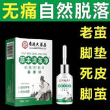 DAGO草本清茧净脚茧祛关节茧手净茧疣子脚底老厚脚垫脚趾+润肤脂