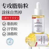 同仁堂脂肪粒去除神器眼部专用去眼部脂肪粒眼袋清肌颗粒眼部精华液30ml