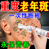肤研老年斑专用特效非药一夜消去斑去黑色素霜去除男士祛斑点斑专用膏 1盒【肤研美白祛斑霜专用医用正品氢醌非乳膏】 美白祛斑霜淡化黑色素黄褐斑雀斑晒斑女士用的中药