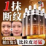 修正抗皱精华液六胜肽紧致精华延缓衰老提拉消除皱纹法令纹抬头纹断纹 5瓶装【周期使用，效果好】