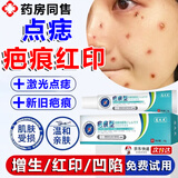点痣后疤痕修复膏除疤膏凹坑增生凸起点痣后去脸上红印黑印激光术后点斑成人儿童专用修复淡化凝胶液 单盒【体验装】
