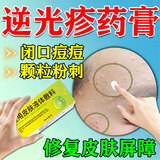 修正逆光疹药膏去闭口粉刺脸上额头长小粒痘痘闭口粉刺修复皮肤屏障膏 1盒.【体验装】 脸上起小疙瘩颗粒修复凝胶学生儿童可用
