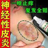 千草本原神经性皮炎专用的药膏顽固皮肤瘙痒皮炎皮癣湿疹真菌感染止痒喷剂 特效：一瓶【神经性皮炎无激素】