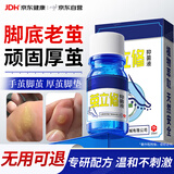 韶琪脚底老茧去除可搭老茧软化膏去脚底老茧去硬皮脚茧厚茧硬皮20ml