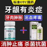 [翔宇乐康]萘普生片 0.1g*50片 1盒+[金口馨]复方氯己定含漱液 150ml 2盒  炎神经痛上火牙疼虫蛀牙疼牙齿酸痛 【治疗牙龈炎