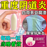 [中大]克霉唑栓 0.15g*10枚 1盒装 阴道炎妇科炎症霉菌性阴道炎宫颈糜烂专用药外阴瘙痒白带豆腐渣阴道塞药妇科用药非处方药 霉菌性阴道炎阴道栓
