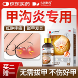 久冈制药甲沟炎专用灰指甲息肉红肿去肉芽发炎流脓外用膏药嵌甲沟炎矫正器