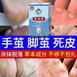 DAGO清茧灵茧立净去老茧子手脚厚去脚底老茧去硬皮软化剂+润肤脂
