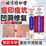 内廷上用痘印痘坑修复凹洞去痘坑填充再生修复痘疤男凹坑淡化消除黑色素 痘印痘坑修复凹洞填充再生 一盒装