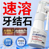 BEAI牙结石冲洗器喷雾牙齿膏口臭去除味去黄溶解液去渍牙石2瓶