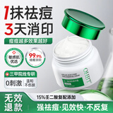 OHBT壬二酸精华霜15%凝胶淡化痘印痘坑去黑头闭口粉刺水杨酸送女友