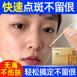 点斑药水去雀斑老年斑点斑专用美容院同款取斑美容金水 一盒