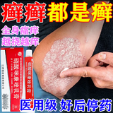 [扬子洲]硝酸咪康唑乳膏 2%*20g 3盒装 体股癣牛皮肤癣专用特正效药银屑病药膏止痒抑菌皮肤皮炎湿疹皮癣真菌感染止痒膏 浑身癣症反复长 好后停药