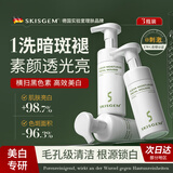 SKISGEM德国进口洁面慕斯氨基酸洗面奶美白淡斑控油提亮去黄男女士 【第三件0元】美白淡斑洁面乳*3