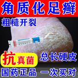 [金归]环吡酮胺乳膏 1%*20g 3盒装 环吡酮胺乳膏治疗真菌感染脚气抗菌 角化型干裂脚气药皮肤用药 角化型脚气脚底皮厚开裂