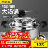 炊大皇 汤锅304不锈钢加厚20cm小奶锅煮面无涂层炖汤锅燃气灶电磁炉通用