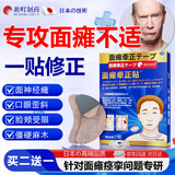 淞町制药面瘫贴后遗症脸部热敷歪嘴眼斜专用口斜面抽蓄痉挛穴位膏药贴神器