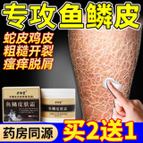 老湖堂鱼鳞皮肤病专用非药膏保湿滋润霜蛇皮肤毛周角化滋润干燥脱皮外用 专攻鱼鳞皮肤 买2宋1 到手3瓶（用完不自卑了）
