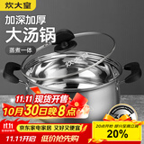 炊大皇 汤锅304不锈钢加厚20cm小奶锅煮面无涂层炖汤锅燃气灶电磁炉通用