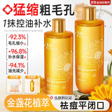 透真金盏花爽肤水控油祛痘收缩毛孔湿敷水保湿补水提亮去黄去闭口粉刺
