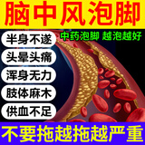 艳锦堂脑梗泡脚中药包脑梗塞偏瘫后遗症言语不清脑中风行动不便舒筋活络 一袋/30包