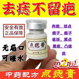 佰萃莱去痣点痣膏药水脸部不留疤祛黑痣香港无痛修复液大药房点尤可用