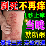 秋雅奈绪皮湿炎疹膏止痒抑菌皮肤瘙痒去顽固湿毒十大牌子真菌感染止痒药膏 1盒【湿诊止痒药膏十大牌子】香港大药房 皮i炎湿i疹皮i癣真菌感染止痒膏效果最好的药